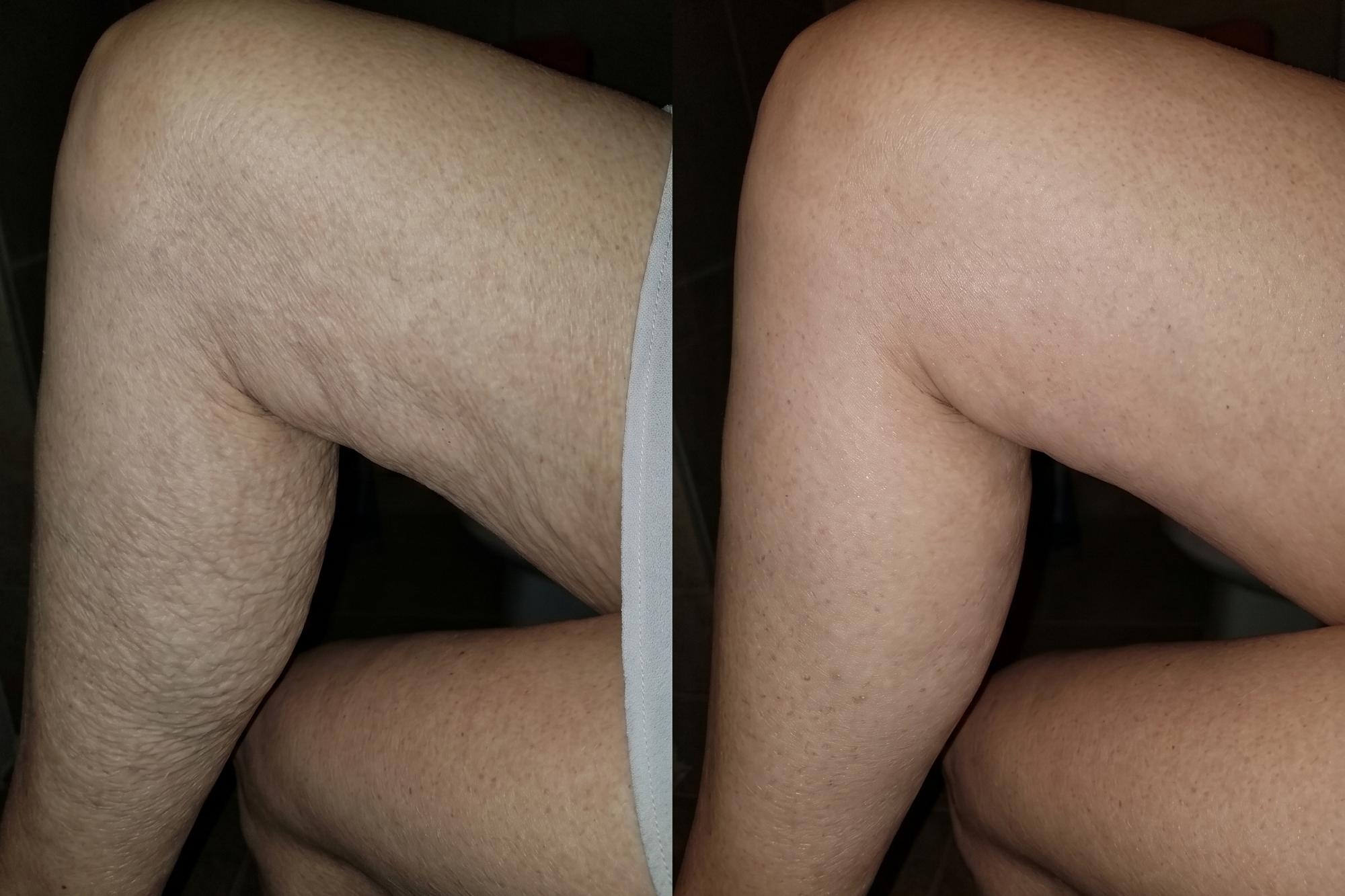 Before and After Results with Cavo Glow Body Oil